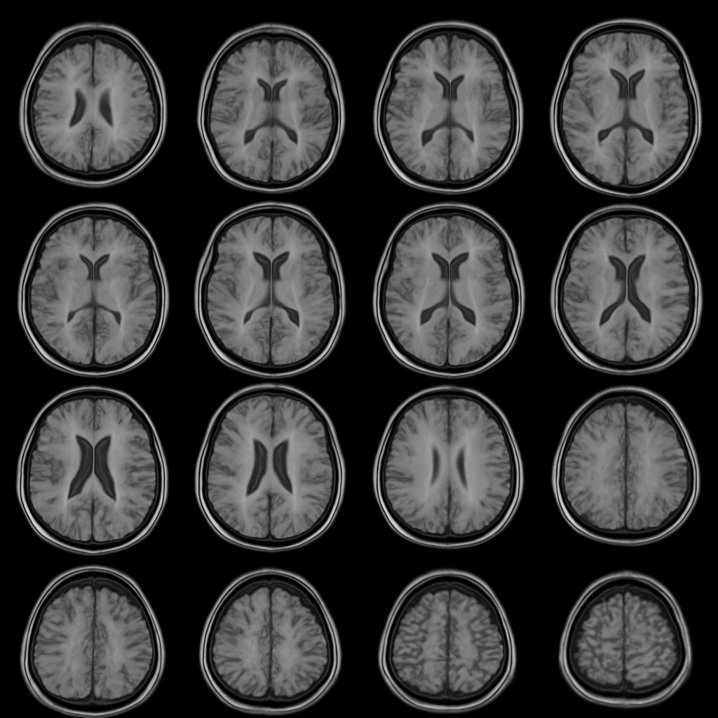 Multi-slice fMRI brain images showing raw input data for task-aligned analysis